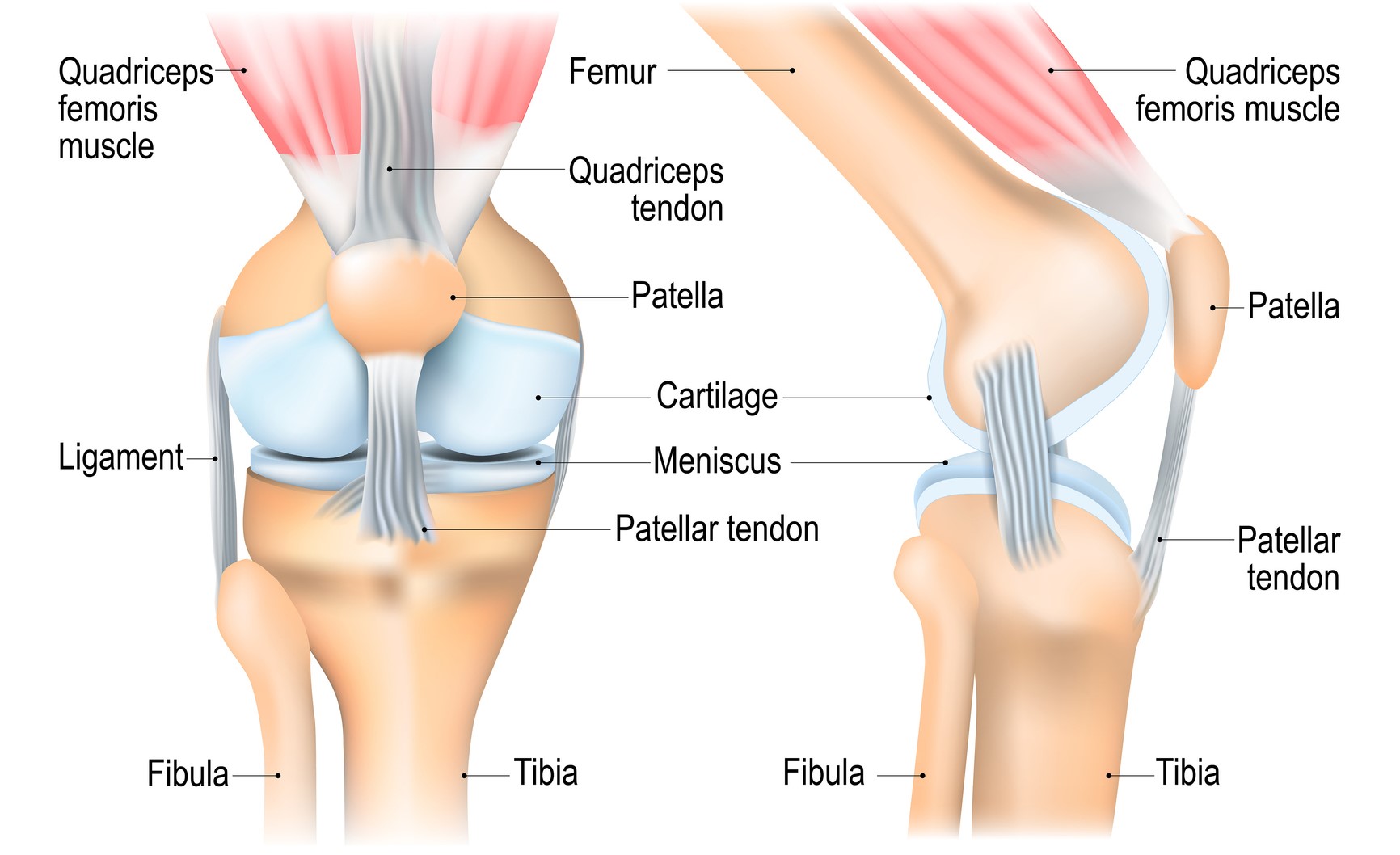 Chondromalacia Patellae Treatment