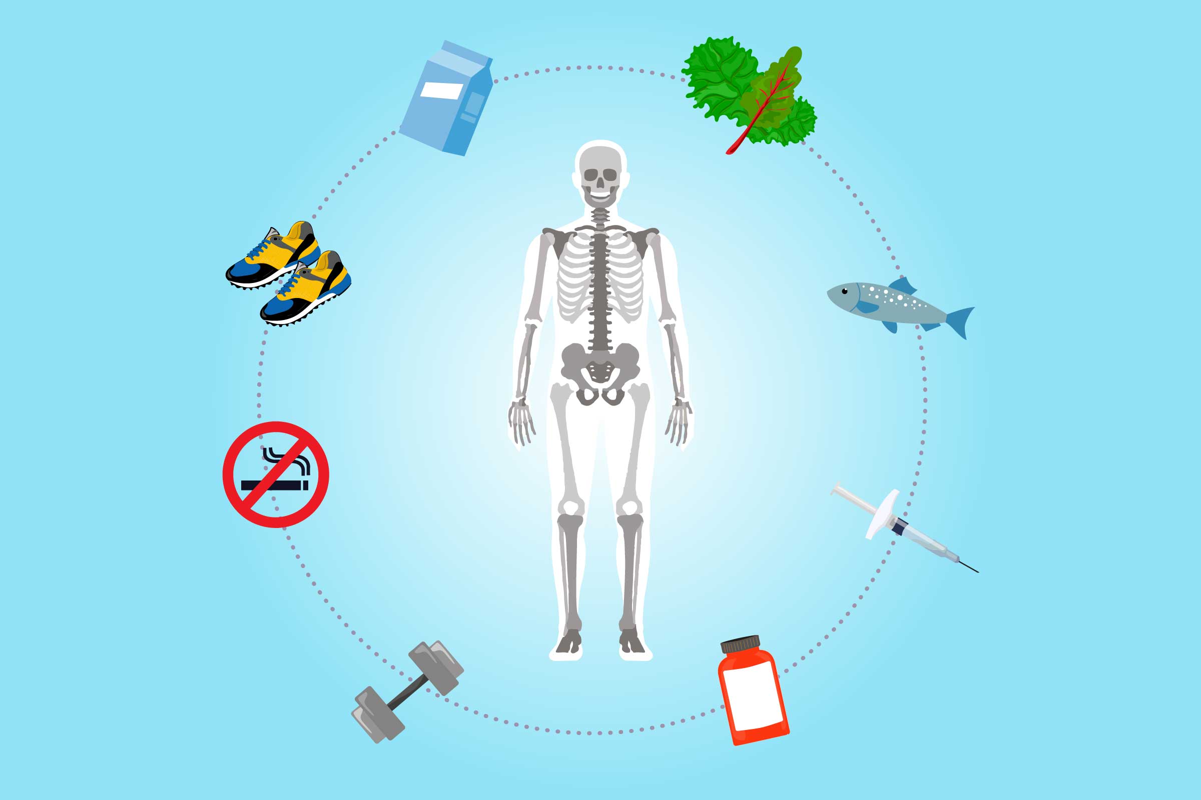 Osteoporosis Prevention