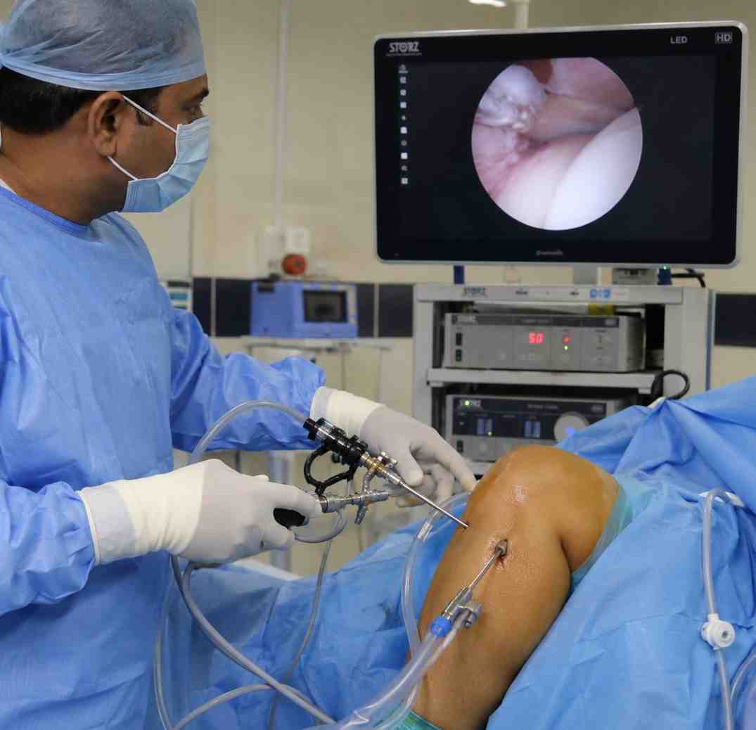 Benefits of Arthroscopic Surgery